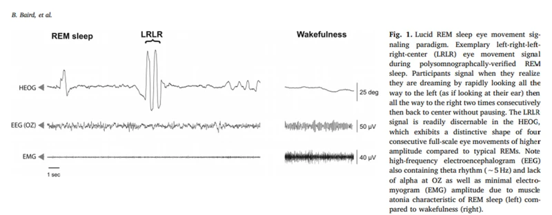 Anwendungen Der Schlaf-Eeg-Analyse In Der Traumforschung