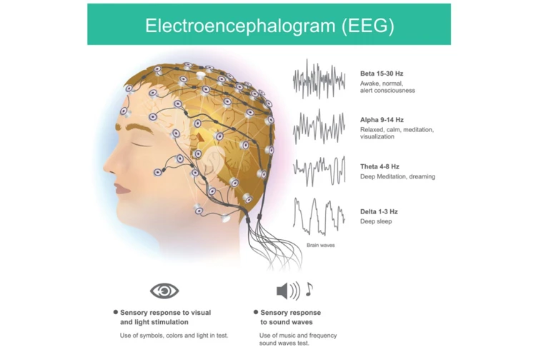 Vorteile Der Schlaf-Eeg-Analyse Für Die Traumdeutung