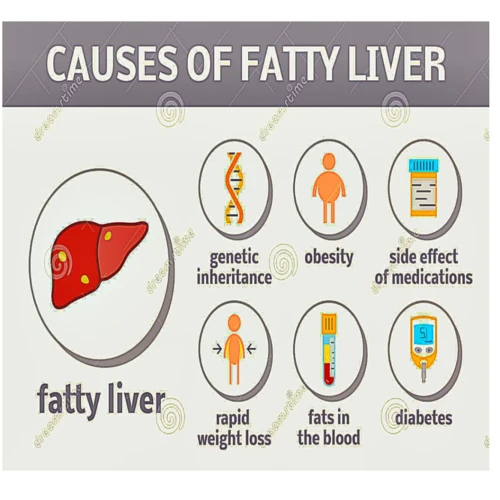 Ursachen Von Fettleber